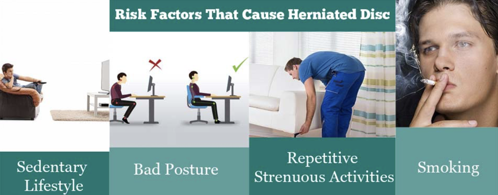 intervertebral disk herniation